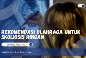  Rekomendasi Olahraga untuk Skoliosis Ringan