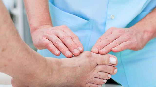 Tulang menonjol di punggung kaki? Hati-Hati Anda Terkena Penyakit Osteofit