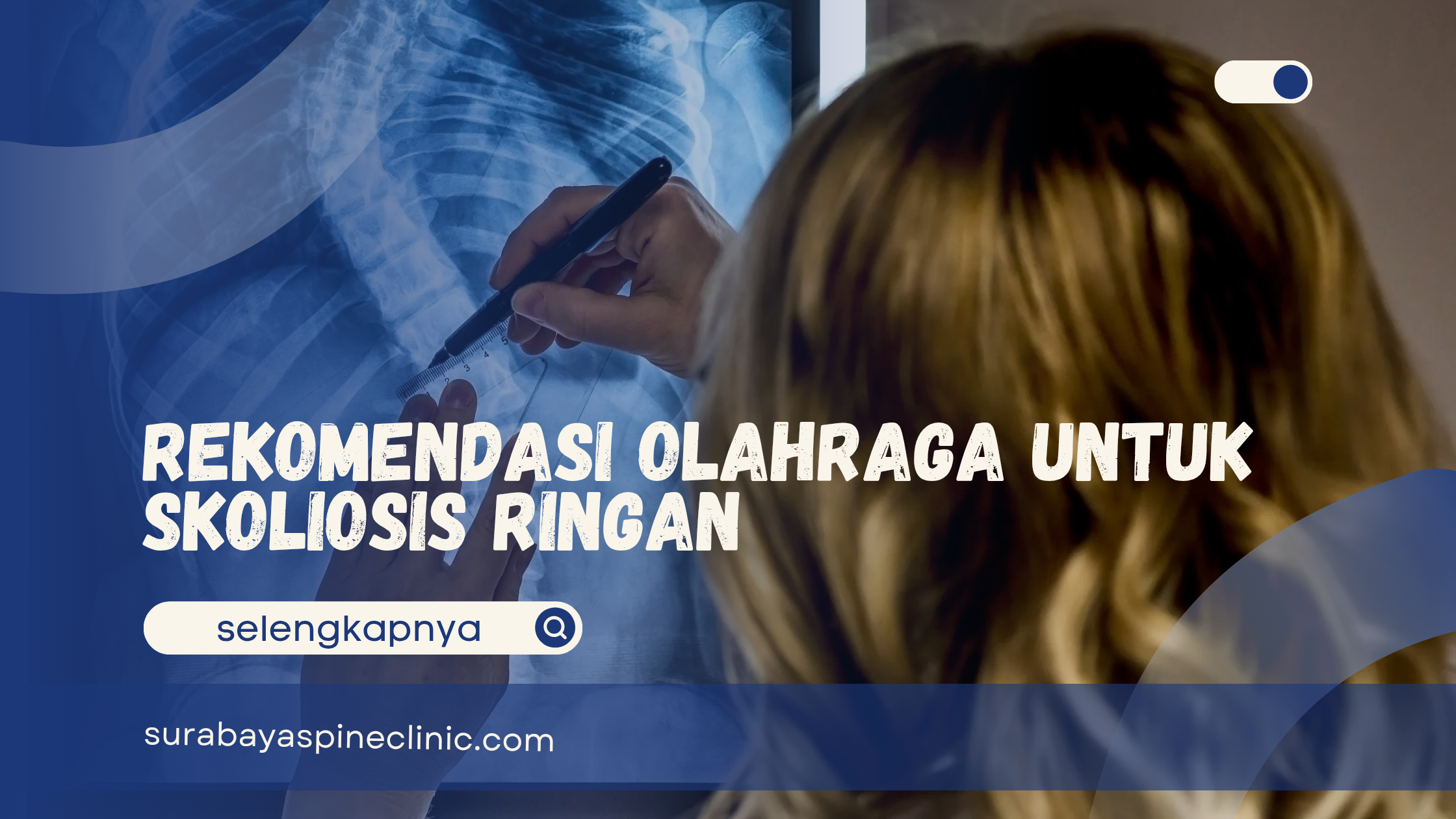  Rekomendasi Olahraga untuk Skoliosis Ringan