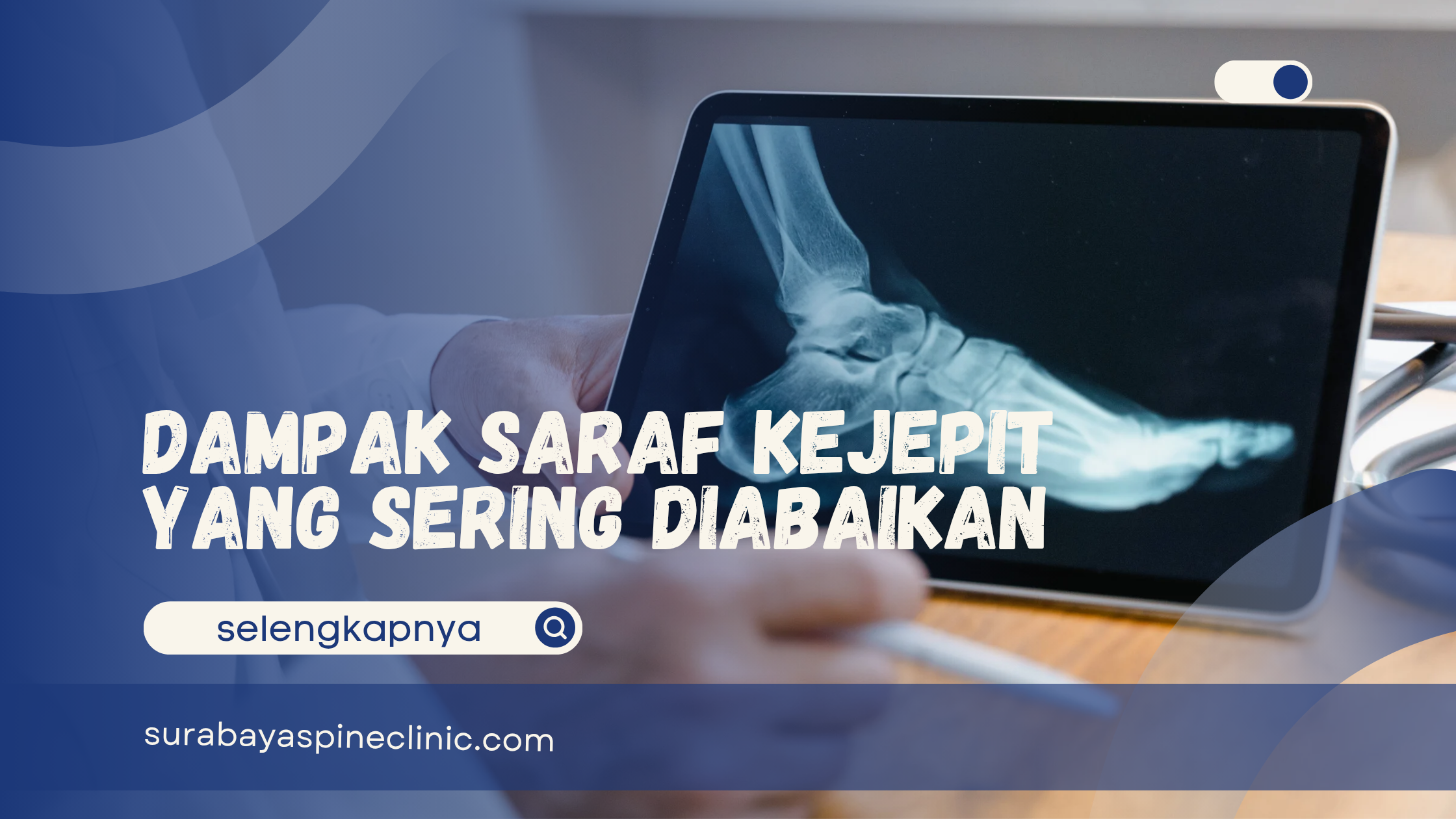 Dampak Saraf Kejepit yang Sering Diabaikan 