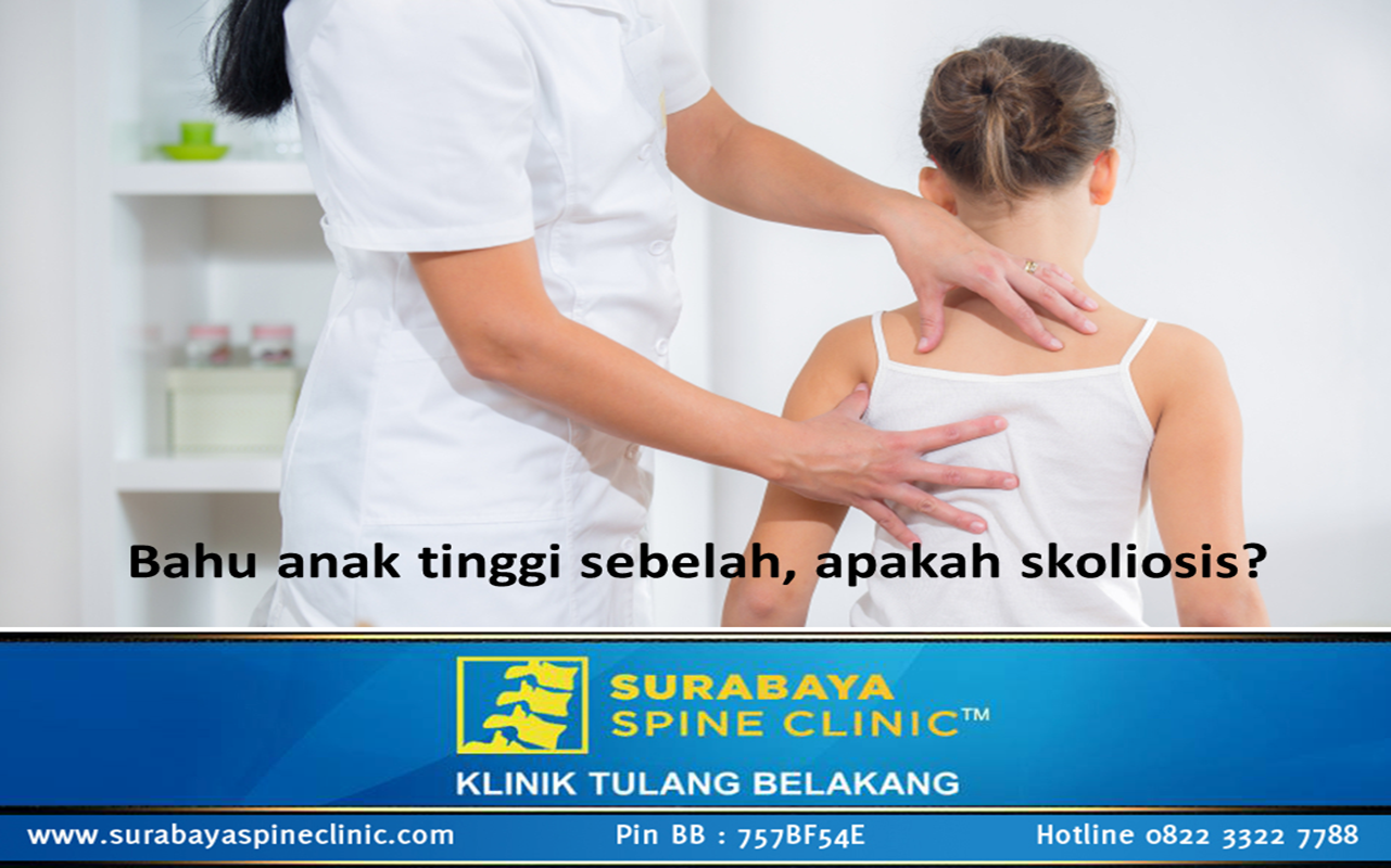 BAHU ANAK TINGGI SEBELAH, APAKAH SKOLIOSIS?