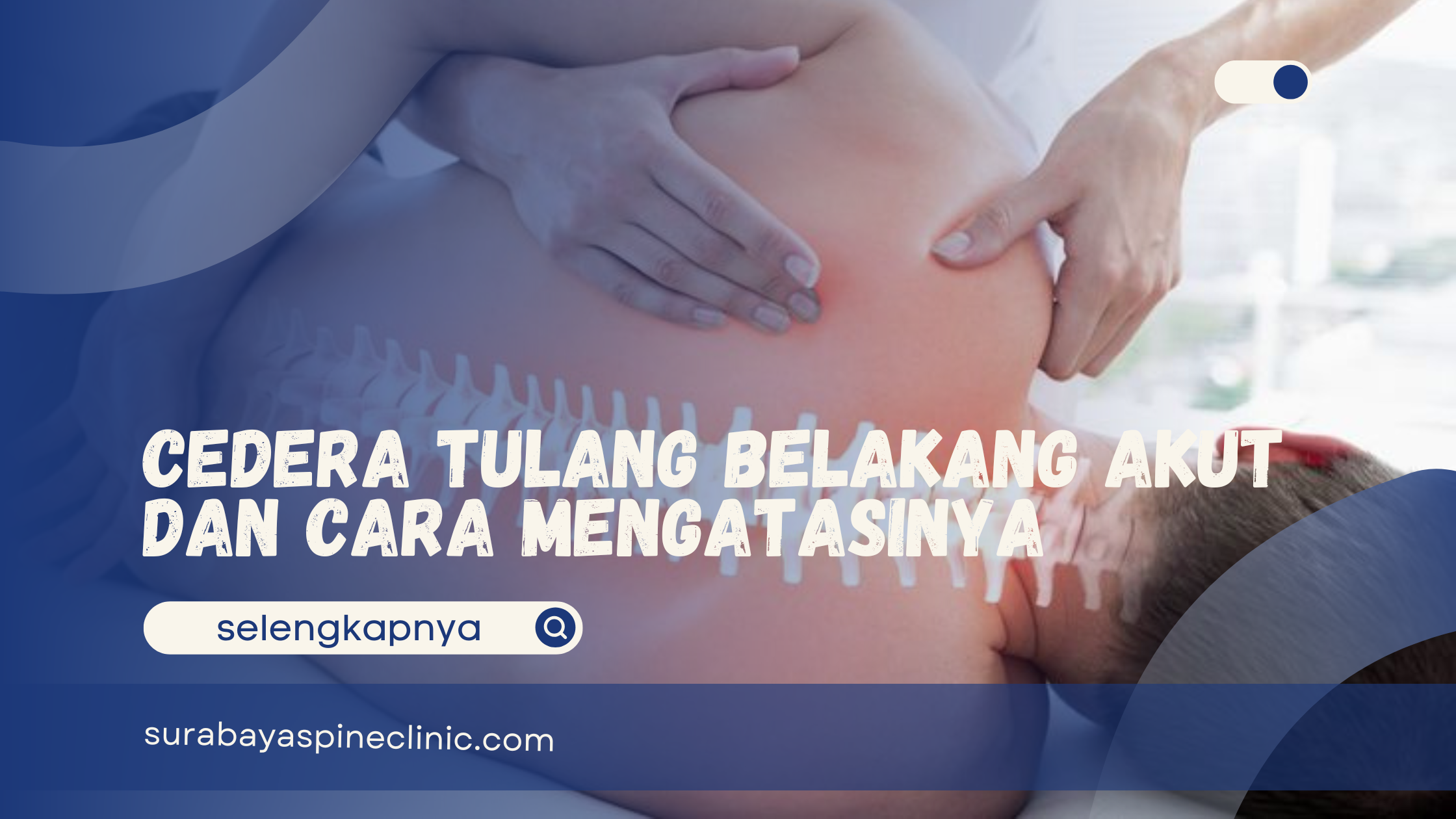 Cedera Tulang Belakang Akut dan Cara Mengatasinya