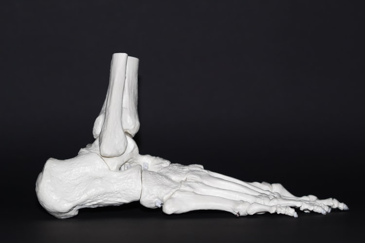 Perhatikan dan Waspadai Benjolan di punggung kaki